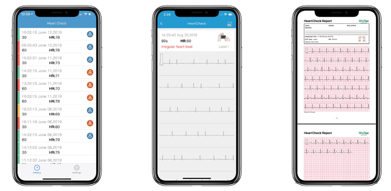Przenośny Aparat EKG Pulsebit z kablem odprowadzeniowym Arytmia zdjęcie 2