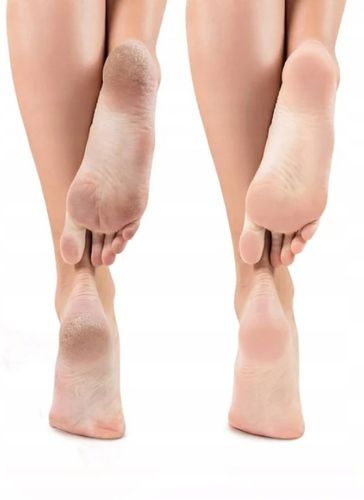 Apis Api-Podo Intensywnie Zmiękczające Perełki Do Stóp z Kwasami AHA na Arena.pl