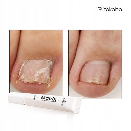 Yokaba Matrix Nail Repair Treatment Preparat do regeneracji paznokci 15ml na Arena.pl