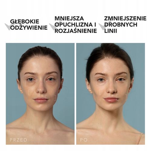 Głęboki nawilżacz do twarzy UFO 3, Czarny na Arena.pl