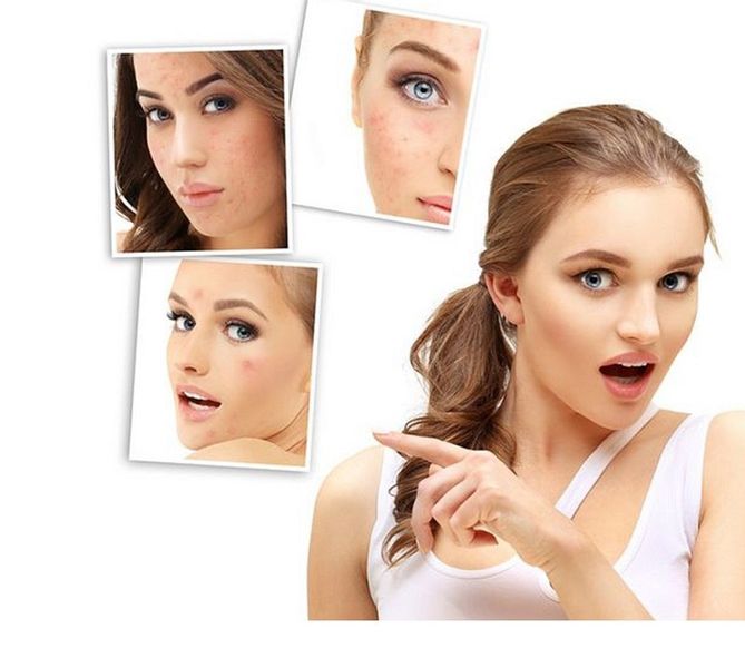 Urządzenie Kosmetyczne Darsonval D'Arsonval Derma zdjęcie 7