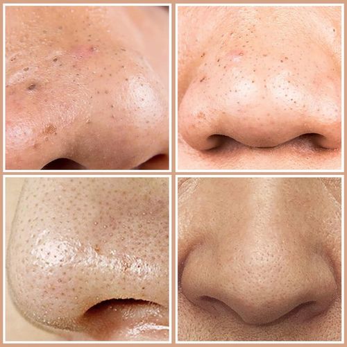 BIAŁA MASKA PILATEN WĄGRY + 60 PLASTRÓW na Arena.pl