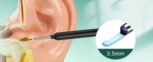 SMART OTOSKOP Z KAMERKĄ WIFI DO CZYSZCZENIA USZU NARZĘDZIA ZESTAW ENDOSKOP na Arena.pl