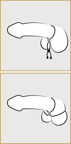 BK cock & ball loop na Arena.pl