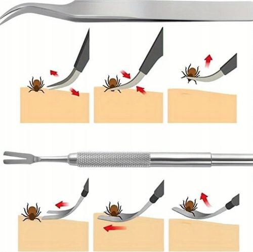 SZCZYPCE PĘSETA DO USUWANIA WYCIĄGANIA KLESZCZY DLA PSA KOTA LUDZI ZESTAW na Arena.pl