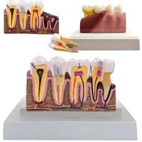 Model anatomiczny zęba stomatologiczny edukacyjny przekrój wyjmowany ząb