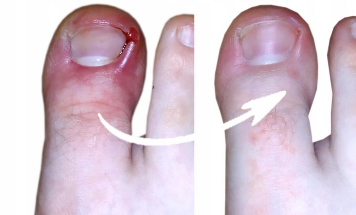 SPRAY NA GRZYBICĘ PAZNOKCI Z JONAMI SREBRA 100ml zdjęcie 4