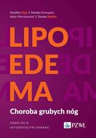 Lipoedema - Artur Mieczkowski