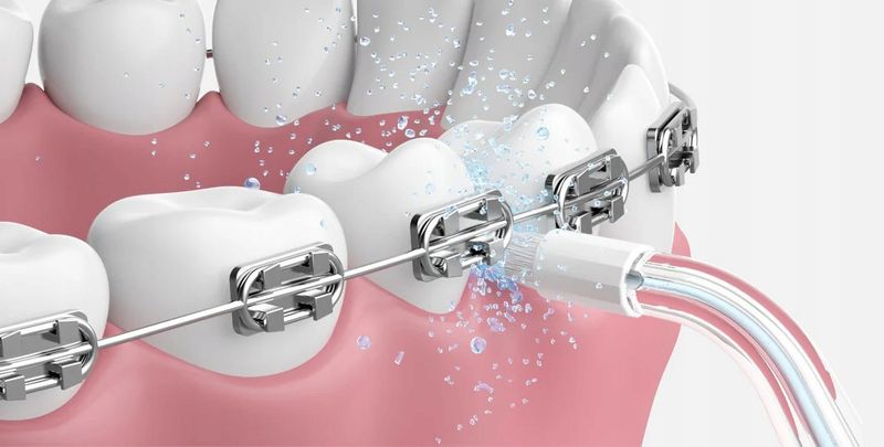 Irygator dentystyczny OCLEAN Airpump A10 Biały zdjęcie 9