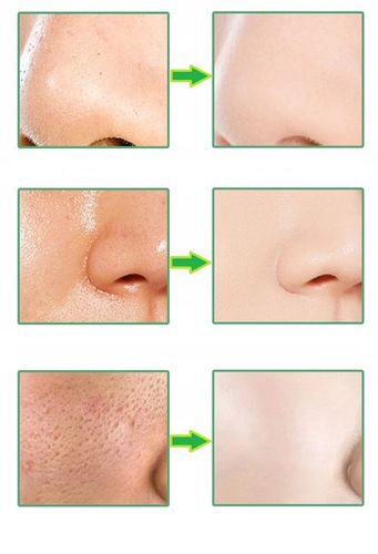 MASECZKA DO TWARZY GREEN TEA STICK OCZYSZCZA WĄGRY MASKA NA TWARZY SZTYFT na Arena.pl