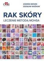 Rak skóry. Leczenie metodą Mohsa - Andrzej Bieniek