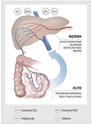 Aboca Metarecod Poprawa Wyników Cholesterolu Trójglicerydów Cukru na Arena.pl