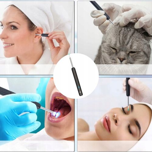 SMART OTOSKOP KAMERA CZYSZCZENIE USZU WOSK WIFI HD APLIKACJA ENDOSKOP na Arena.pl