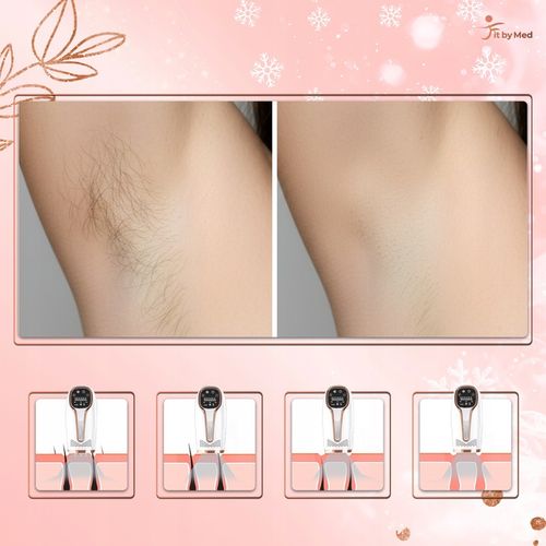 DEPILATOR LASEROWY IPL DO WŁOSÓW TWARZY CIAŁA BIKINI DEPILACJA na Arena.pl