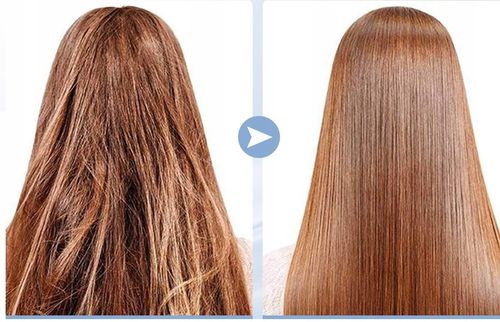 URZĄDZENIE Darsonval Derma Wand PRO LZ006A 4 ELEKTRODY OZON MIKROPRĄDY na Arena.pl