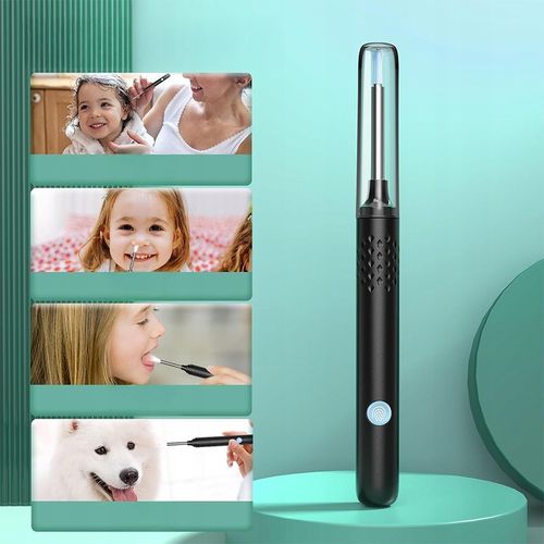 SMART OTOSKOP Z KAMERKĄ WIFI DO CZYSZCZENIA USZU NARZĘDZIA ZESTAW ENDOSKOP na Arena.pl