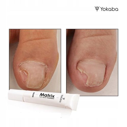 Yokaba Matrix Nail Repair Treatment Preparat do regeneracji paznokci 15ml na Arena.pl