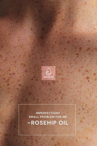 Olej z Dzikiej Róży 100ml Wenatural - na trądzik przebarwienia na Arena.pl