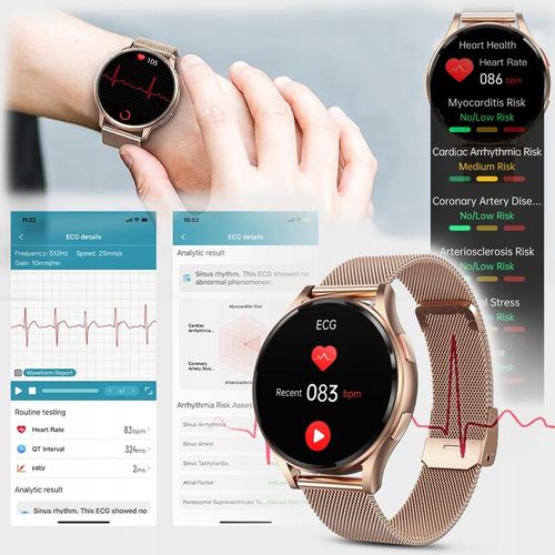 SMARTWATCH DAMSKI AMOLED KARDIOWATCH POMIAR EKG HRV CIŚNIENIE ROZMOWY SMS na Arena.pl