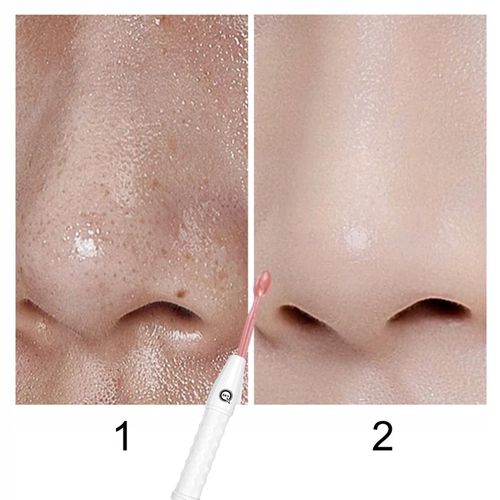 DARSONVAL QSKY DERMA WAND 4w1 PRO DO PIELĘGNACJI TWARZY ZMARSZCZEK I WŁOSÓW na Arena.pl