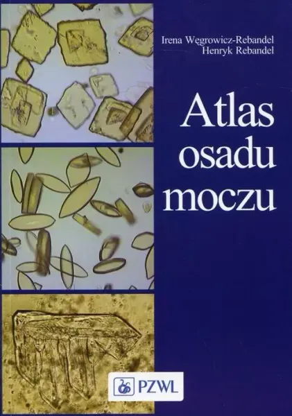 Atlas osadu moczu zdjęcie 1