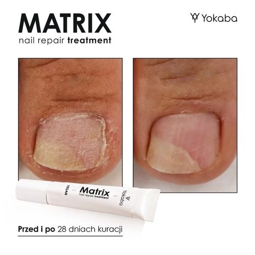 Yokaba MATRIX Preparat do regeneracji macierzy paznokcia 15 ml na Arena.pl