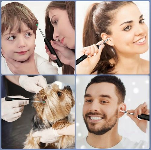 ZESTAW DO USUWANIA WOSKOWINY Z KAMERĄ 8 MEGAPIXELI HD 6 LED ENDOSKOP na Arena.pl