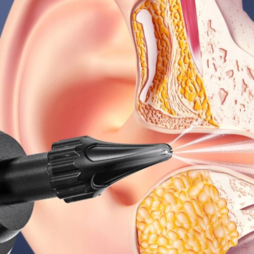 IRYGATOR URZĄDZENIE CZYSZCZENIA USZU PŁUKANIA WOSKOWINY BEZPRZEWODOWY na Arena.pl