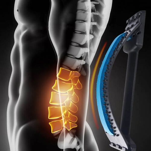 Back Magic Przyrząd do Rozciągania Pleców na Arena.pl