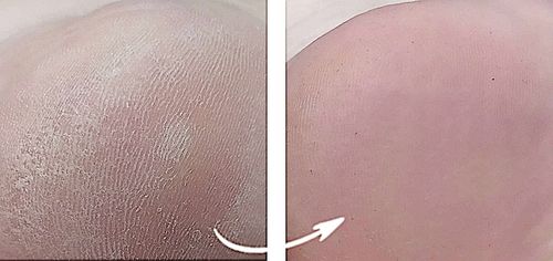 SPRAY NA GRZYBICĘ PAZNOKCI Z JONAMI SREBRA 100ml na Arena.pl