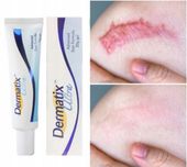 Dermatix żel na blizny 15 g