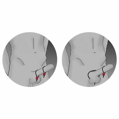 electrastim prestige electraloops czarne - regulowane na Arena.pl