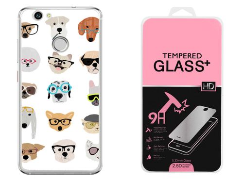 HUAWEI NOVA | Etui smartfon CASE + Szkło na Arena.pl