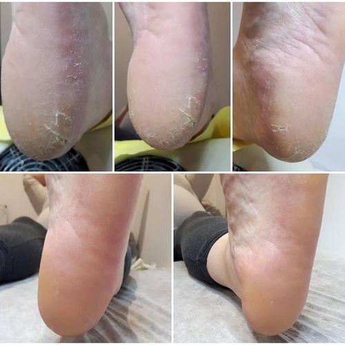 SALU Płyn do zmiękczania naskórka 250 ml do pedicure cuticle remover na Arena.pl