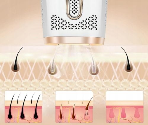 DEPILATOR LASEROWY IPL DO WŁOSÓW TWARZY CIAŁA BIKINI DEPILACJA na Arena.pl