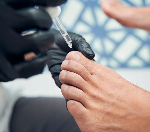 Arkada Serum TC16 Kolagenowe do Paznokci i Skóry Onycholiza 11ml na Arena.pl