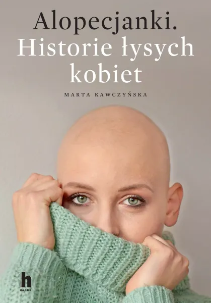 Alopecjanki. Historie łysych kobiet zdjęcie 1