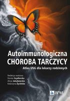 Autoimmunologiczna choroba tarczycy Szydlarska Dorota, Jakubowska Alicja,…