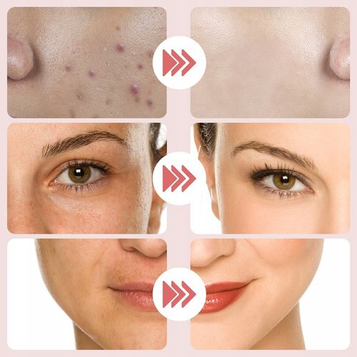 FOONNUN BEZIGŁOWA MASAŻER EMS TWARZY LIFTING 7w1 URZĄDZENIE DO MASAŻU na Arena.pl