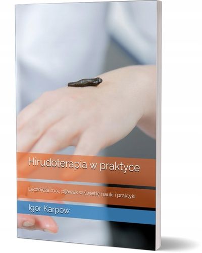 Hirudoterapia w praktyce: Lecznicza moc pijawek w świetle nauki i praktyki na Arena.pl
