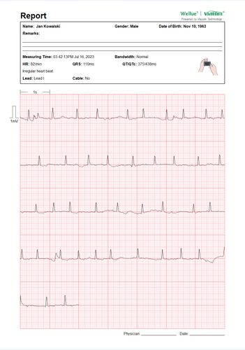 Przenośny Aparat EKG Pulsebit z kablem odprowadzeniowym Arytmia na Arena.pl