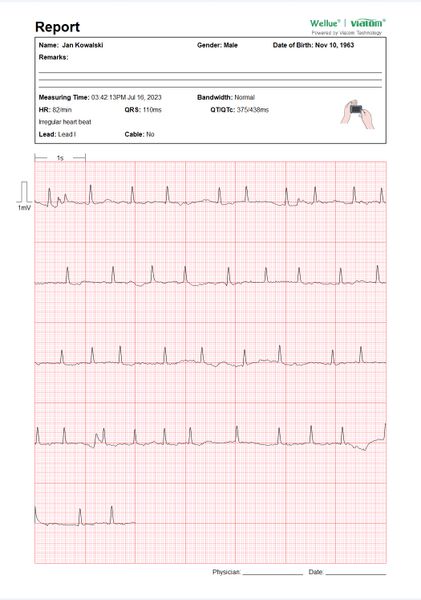 Przenośny Aparat EKG Pulsebit z kablem odprowadzeniowym Arytmia zdjęcie 4