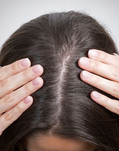 Kuracja przeciw wypadaniu włosów Seboradin FORTE 14 x 5,5 ml na Arena.pl