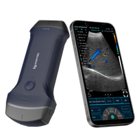 Dwu-głowicowy Aparat USG 3w1 + kolor doppler WIFI USB (Wersja ulepszona)