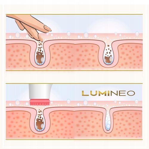 Lumineo Brush PRO różowy 4 końcówki + żel do skóry wrażliwej na Arena.pl