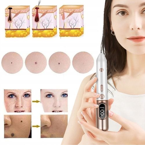 PIÓRO DO LASER USUWANIA ZNAMION PLAZMOWE DO USUWANIA BRODAWEK PIEPRZYK na Arena.pl