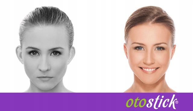 Otostick Plastry Korektory na Odstające Uszy zdjęcie 2