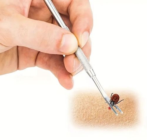 SZCZYPCE PĘSETA DO USUWANIA WYCIĄGANIA KLESZCZY DLA PSA KOTA LUDZI ZESTAW na Arena.pl