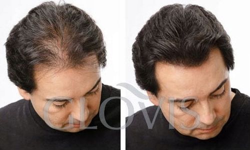 GLOVIS Concealer - Zagęszczanie Włosów Brody Mikrowłókna Pasta na Arena.pl