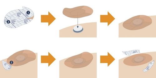 PLASTRY OCHRONNE NA SENSOR CURETAPE CGM do FREESTYLE LIBRE - MIX - 8 na Arena.pl